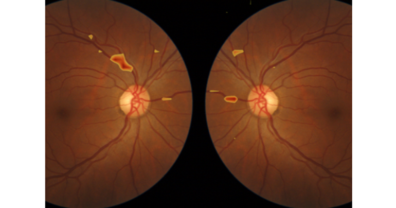 4 proyectos finalistas en los Premios a la Innovación Social de Fundación MAPFRE impulsan la mejora de la calidad de vida con IA y tecnología